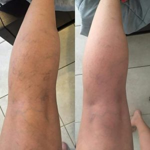 1f1224d4e2c9cae7d0366e942ac3dcd8