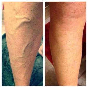 5bbd272faa7b38b32ccd7a8d7697b123